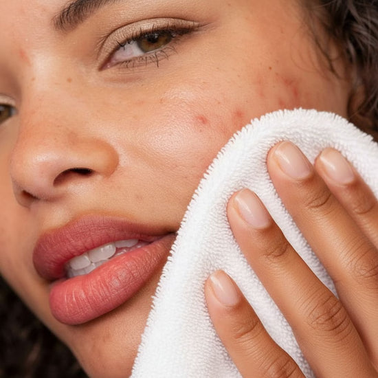 You have breakouts.